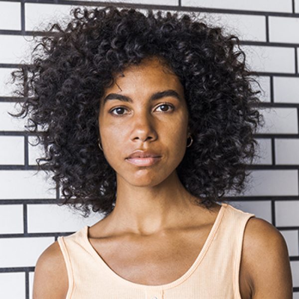 How to Treat Seborrheic Dermatitis with Curly Hair