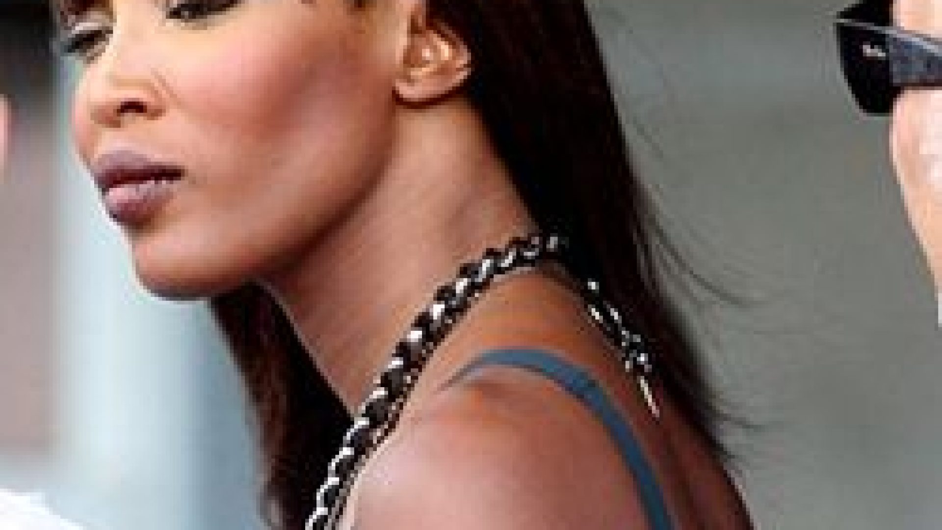 Top 8 Temple & Nape Treatments for Thinning Edges